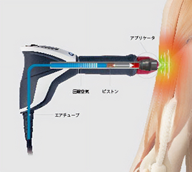 ショックマスター（拡散型ショックウェーブ）