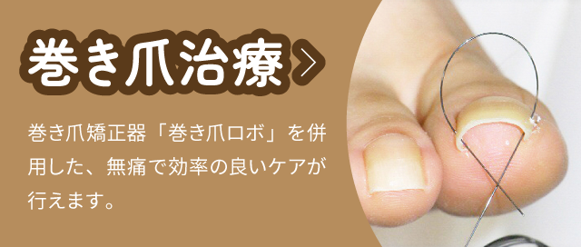 巻き爪治療：巻き爪矯正器「巻き爪ロボ」を併用した、無痛で効率の良いケアが行えます。