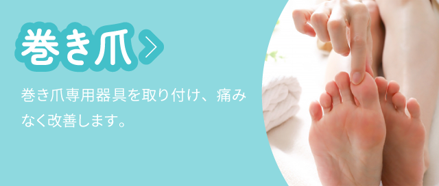 巻き爪：巻き爪専用器具を取り付け、痛みなく改善します。